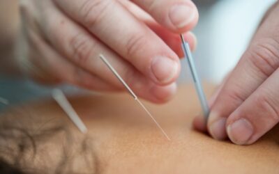 Acupuncture alcool