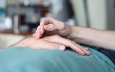 acupuncture
