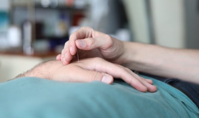 acupuncture